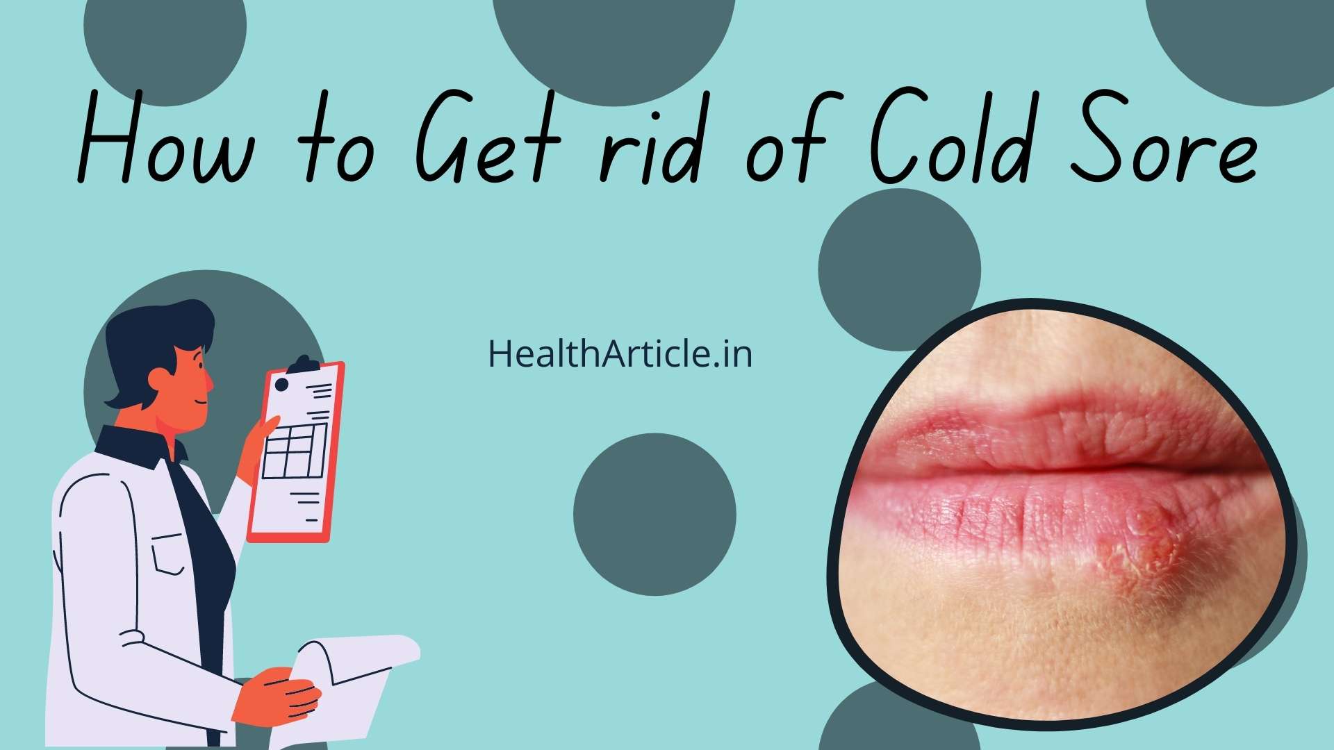 How To Get Rid Of Cold Sores Fast | 7 Magical Remedies